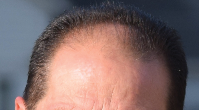 Council member’s criminal past back in focus